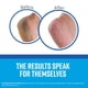 thumbnail image 2 of Crema para pies O'Keeffe's for Healthy Feet, tubo de 200 ml, 2 of 6