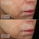thumbnail image 3 of Sérum Facial Sente HydraFirm 30 mL 1.0 fl oz HSA Péptidos, 3 of 3
