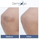thumbnail image 4 of Crema Con Vitamina K Hidratante Para Curar Moretones, 4 of 8