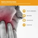 thumbnail image 3 of Protector dental nocturno Nouth Guard Neomen para rechinar los dientes, 3 of 3