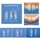 thumbnail image 2 of Bandas dentales de matriz transparente RWBATT Bioclear Style (1909), 2 of 5