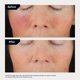 thumbnail image 5 of Complejo corrector Serum Revision Skincare C+ 30%® 15 ml, 5 of 6