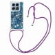 thumbnail image 1 of Funda FOXDOCK para Xiaomi 14T Pro con Cuerda Ajustable, Brillo Líquido, Protección Antigolpes y Lente – Ideal para Regalo, 1 of 6