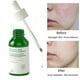thumbnail image 2 of Salicylic Acid Pore Shrinking Essence Anti-acne Exfoliating Blackhead Remover Face Spot Removal Essence Beauty Health Skin Care, 2 of 3