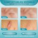 thumbnail image 3 of Crema cicatricial ClearPiny Advanced Silicone Technology 50 ml, 3 of 6