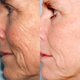 thumbnail image 5 of Kit de microdermoabrasión PMD Beauty Microderm Classic para rostro, 5 of 9