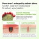 thumbnail image 4 of Multi Balm Stick Dr. Melaxin Cactox Pore Relief Refrigerante Skin Care, 4 of 7