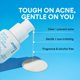 thumbnail image 2 of Serum innisfree, tratamiento suave con retinol salicílico para el acné, 50 ml, 2 of 9