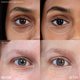 thumbnail image 2 of Corrector Winky Lux Light 10 ml Sin Pliegues, 2 of 9
