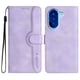 thumbnail image 1 of Funda FOXDOCK para Xiaomi Redmi A5 -Diseño elegante,Ideal para hombres y mujeres, 1 of 5
