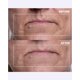thumbnail image 3 of Parche Antiedad Wrinkles Schminkles 2 Unidades Reutilizables, 3 of 7