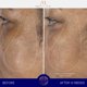 thumbnail image 5 of Suero facial Augustinus Bader 15 ml, 5 of 9