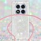 thumbnail image 4 of Funda FOXDOCK para Xiaomi Redmi Note 14 Pro 5G con Cuerda Ajustable, Brillo Líquido, Protección Antigolpes y Lente – Ideal para Regalo, 4 of 6