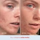 thumbnail image 5 of Crema hidratante First Aid Beauty Ultra Repair, 60 ml, 5 of 9