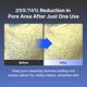 thumbnail image 3 of Pads Tonificantes PO:DL Frozen Hyaluronic Essence 70 unidades, 3 of 8