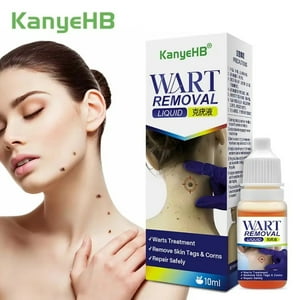 Kanyehb - Wart Ungüento Eliminador De Verrugas Y Condilomas