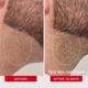 thumbnail image 5 of Pads para vellos encarnados First Aid Beauty BHA AHA 28 unidades, 5 of 9