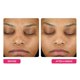 thumbnail image 4 of Almohadillas Peel BeautyStat AHA BHA para Exfoliación Facial, 4 of 6
