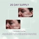 thumbnail image 3 of Almohadillas Para Ojos Silicona Reutilizables Suministro Para 20 Días, 3 of 8