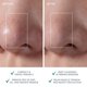thumbnail image 5 of Cepillo limpiador facial y masajeador facial reafirmante FOREO Luna 4 go, 5 of 7