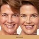 thumbnail image 2 of Corrector The Ideal Fix Medium, 2 of 9