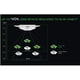 thumbnail image 3 of Accesorio Nyko Zoom para Kinect Xbox 360, 3 of 7