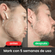 thumbnail image 2 of Mimoxidil Kirkland Cremiento De Barba (1 Mes) 60ml + Gotario, 2 of 2