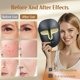 thumbnail image 2 of Mascarilla Facial LED Kelyoo con Terapia de Luz Roja y Azul Anti-Envejecimiento, 2 of 6