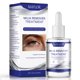 thumbnail image 1 of Suero TRUERELIEF Milia Care para Rostro y Contorno de Ojos 30 mL, 1 of 9