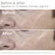 thumbnail image 2 of Protector solar SkinMedica Total Defense + Repair SPF 34 68 ml, 2 of 5