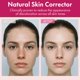 thumbnail image 4 of Crema facial Roseblem 50 g Arbutina 7 % + Ácido tranexámico 4 % (2 unidades), 4 of 9