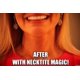 thumbnail image 3 of Tiras Lifting de Cuello NeckTITE Magic para Alisar Arrugas al Instante, 3 of 5
