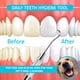 thumbnail image 5 of Raspador de sarro dental Utopia Care de 16,5 cm, doble punta, 5 of 8