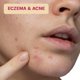 thumbnail image 4 of Toallitas con ácido hipocloroso BASE LABORATORIES para rostro y piel 75, 4 of 9