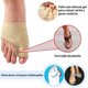 thumbnail image 3 of Par Calcetines Protectores Para Juanetes Separador De Dedo Beige, 3 of 5