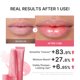 thumbnail image 4 of Bálsamo labial medicube 10 g brillante con péptidos y efecto voluminizador, 4 of 8