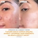thumbnail image 5 of Suero Skinfix Brighten + Firm con 15% de vitamina C 30 mL para el rostro, 5 of 9