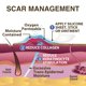 thumbnail image 5 of Parche de silicona para cicatrices Biodermis Epi-Derm 2 x 2.5 pulgadas (1 par), 5 of 7