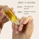 thumbnail image 3 of Sérum para el crecimiento de uñas Botanist, 100% activos de origen vegetal, vegano, 3 of 5
