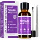 thumbnail image 1 of Tratamiento para Hongos en las Uñas PURESKIN 30 ml Ácido Undecilénico 25%, 1 of 6