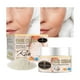 thumbnail image 2 of Crema Facial Arroz Antiarrugas Blanqueadora Acné, 2 of 5