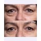 thumbnail image 3 of Parche antiarrugas Wrinkles Schminkles 3 pares + 2 unidades, 3 of 8