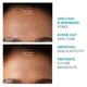 thumbnail image 5 of Herramienta facial contra imperfecciones FOREO KIWI - Eliminador de puntos negros y blancos, 5 of 6