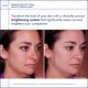 thumbnail image 3 of Set de cuidado de la piel Obagi Medical Nu-Derm System para piel normal a seca, 3 of 6
