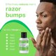 thumbnail image 3 of Ingrown Hair Treatment Gel with Salicylic Acid, Razor Bump Relief, 3 of 3