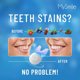 thumbnail image 3 of Kit Blanqueador Dental MySmile LED 10 min No Sensible, 3 of 3