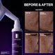 thumbnail image 4 of Suero facial La Roche-Posay 40 ml Mela B3 Doble Dosis, 4 of 9
