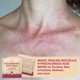 thumbnail image 3 of Toallitas con ácido hipocloroso BASE LABORATORIES para rostro y piel 75, 3 of 9