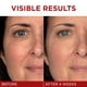 thumbnail image 3 of Crema hidratante L'Oreal Paris Revitalift Triple Power Antienvejecimiento, 3 of 3