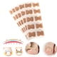 thumbnail image 3 of Pegatina De Corrección De Uñas Encarnada, 3 of 5